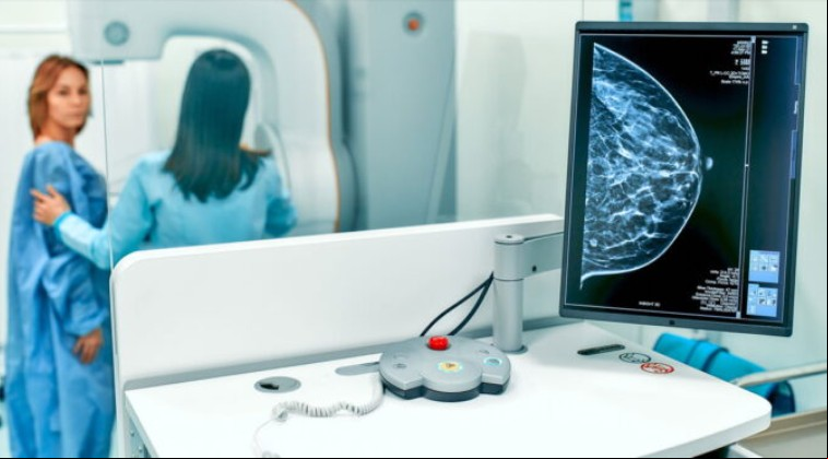 Novo exame promete revolucionar detecção precoce do câncer de mama 